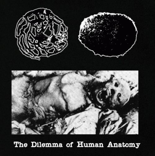 Stercoraceous Copremesis Rhinorrhea : The Dilemma of Human Anatomy Stercoraceous Copremesis Rhinorrhea : The Dilemma of Human Anatomy